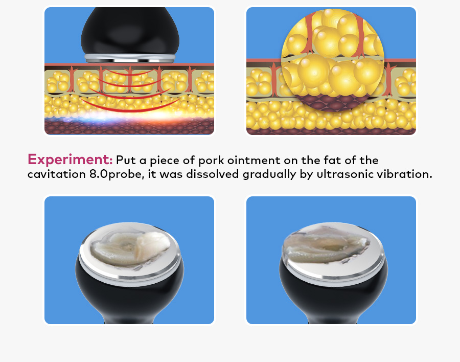 ultrasonic fat burning