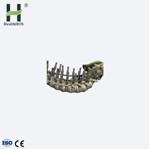 Placca di fissazione in titanio posteriore per vertebre cervicali