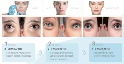Wholesale Ami Eyes Removing Dark Circle Under Eye Wrinkles Treatment Eye Bag Lumi Eyes