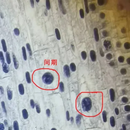 Mitosis Slides Set - Onion Root Tip 5pcs - FRT1001 - Plant Genetics and Biology