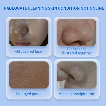 Azelaic Acid Cleaning Mud Film Pore Face Deep Cleaning Facial Mask