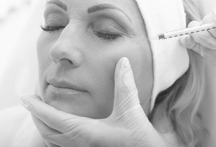 dermal fillers