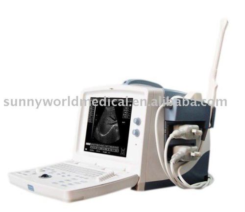 SW-US3000D2 digital ultrasound scanner for Portable doppler Ultrasound Scanner