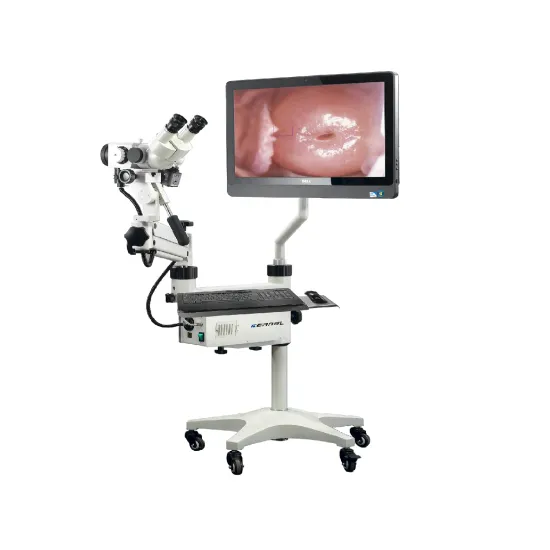 Affordable Portable Video Colposcope: A Factory Direct Female Gynecological Imaging System
