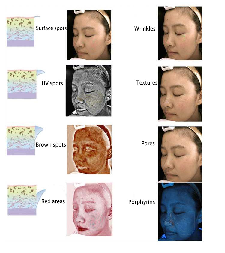 Skin Tone Analyzer Online