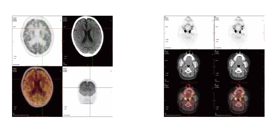 Tomography Pet Ct Scanner, High Quality Tomography Pet Ct Scanner on ...