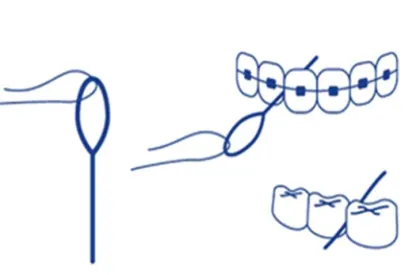 Soft Orthodontic Dental Floss