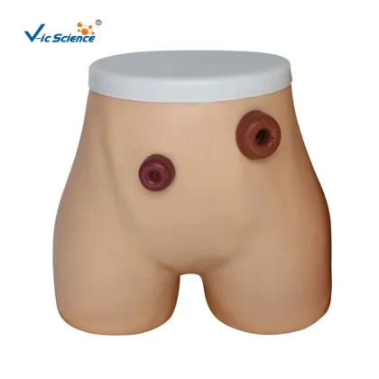 Ostomy Medical Nursing Model