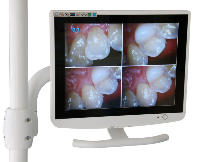 15 Inch White Dental LCD Monitor for Dental Camera with VGA & Video & HDMI & USB Jack