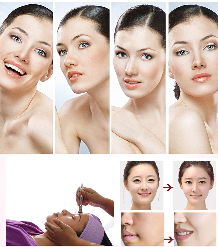 diamond dermabrasion facial