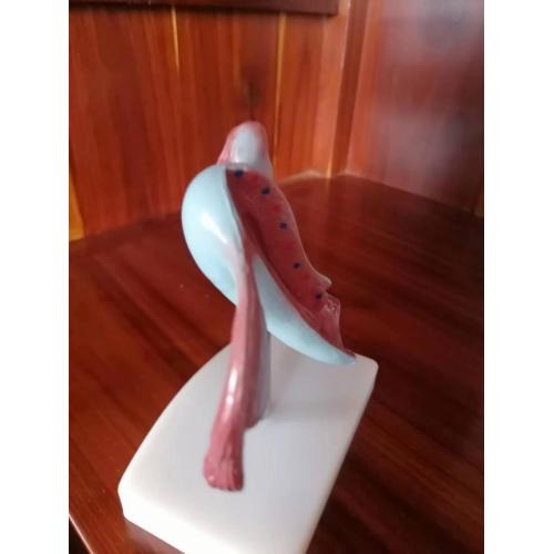 Larynx Heart And Lung Model Uterus Model with Pathology Factory