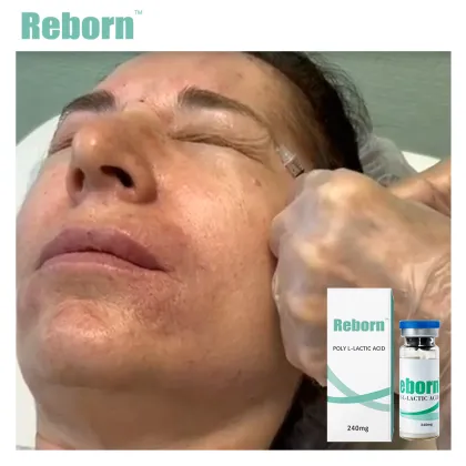 Medical Cosmetic Filler for Skin