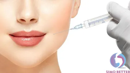 Hyaluronate Acid Gel Dermal Filler to Enhance your Beauty