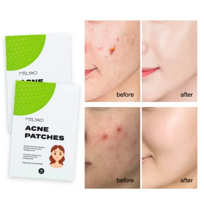Blemishes Spot Stickers Vegan Waterproof Acne Patches