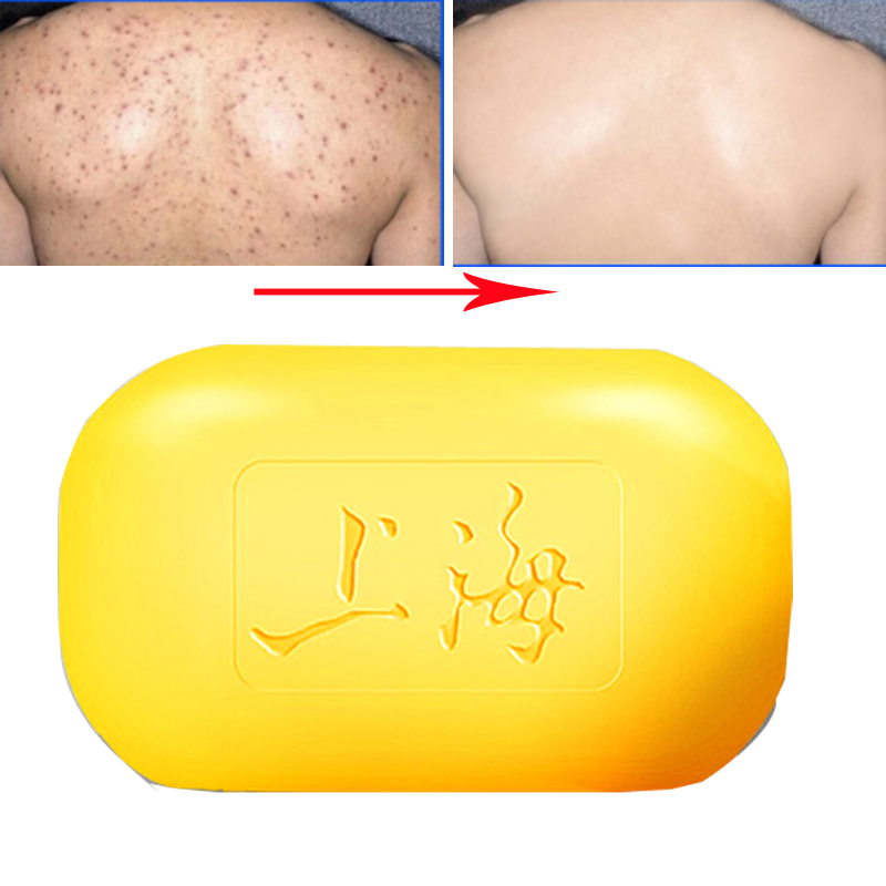 Shanghai Sulfur Soap Oil-Control Acne Treatment lackhead Remover Soap 85g Whitening Cleanser Chinese Traditional Skin Care
