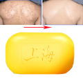 Shanghai Sulfur Soap Oil-Control Acne Treatment lackhead Remover Soap 85g Whitening Cleanser Chinese Traditional Skin Care