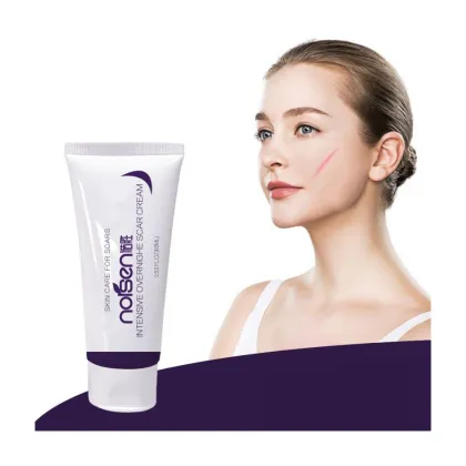 Best Wholesale Scar and Stretch Mark Removal Cream