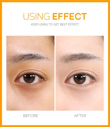 Korean Eye Cream for Tightening, Dark Circles, and Puffiness