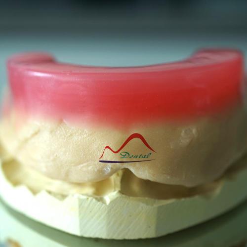 Dental Red Wax Rims