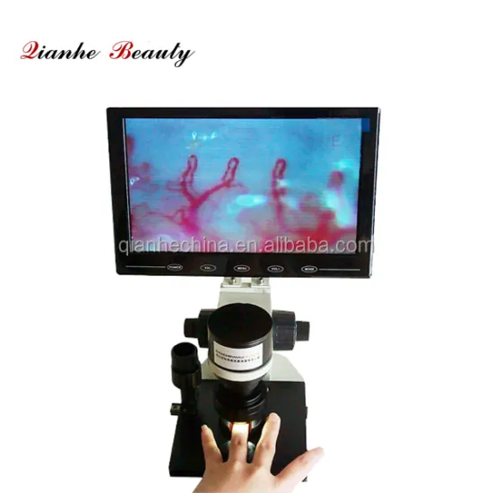 High quality capillaroscope detector microcirculation machine for sale
