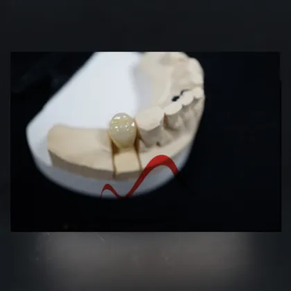 Totally bio compatible  Zirconia Crown