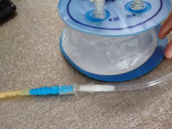 Negative pressure drainage reservoir surgical drainage