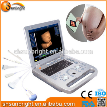 color ultrasound/4d ultrasound