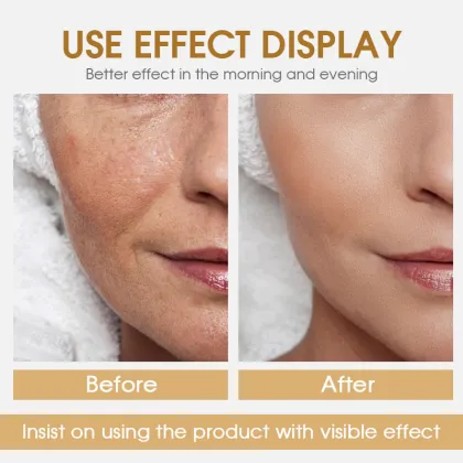 Snail Collagen Whitening Facial Cream Natural Facial Cream