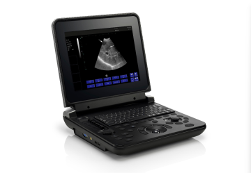 Fully Digital Diagnostic Ultrasound System