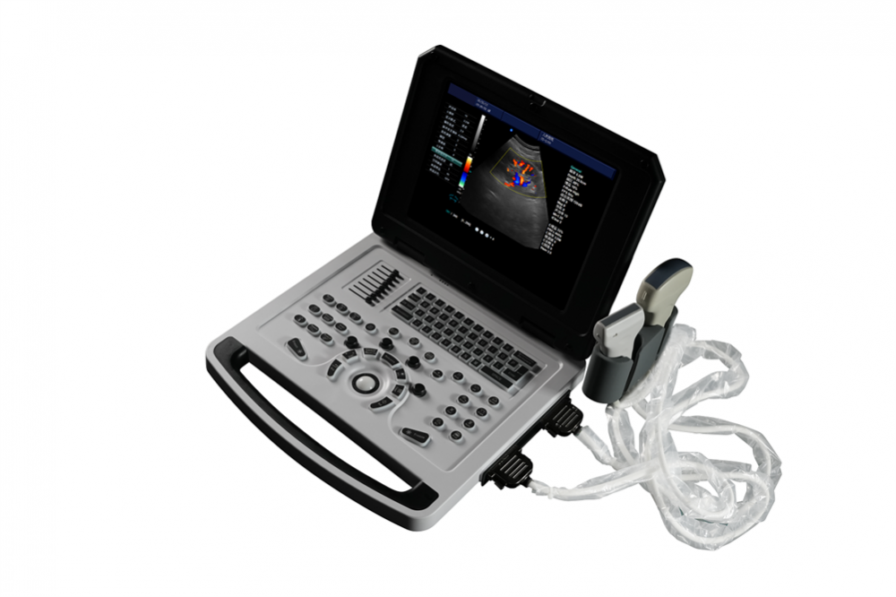 Notebook -Farbdoppler -Ultraschall -Scanner für die Gynäkologie
