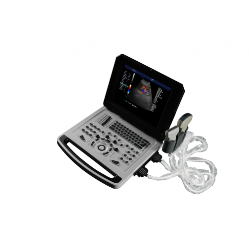 Gynecology Examination Instrument Notebook Color Doppler Ultrasound Scanner for Gynecology Supplier