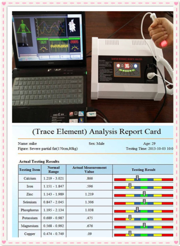 2014 Latest Original 39 Reports Professional Body Quantum Resonance Magnetic Analyzer