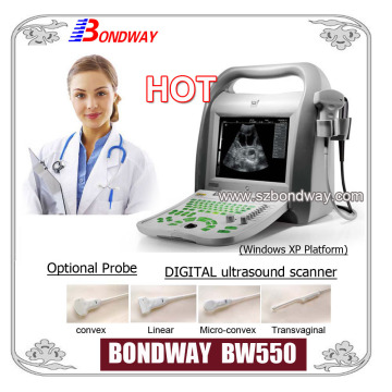 Digital Portable Ultrasound Ob Ultrasound Ultrasound Machine