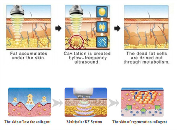 Cellulite Removal Multifunction Beauty Equipment With PDT Vacuum Cavitation RF