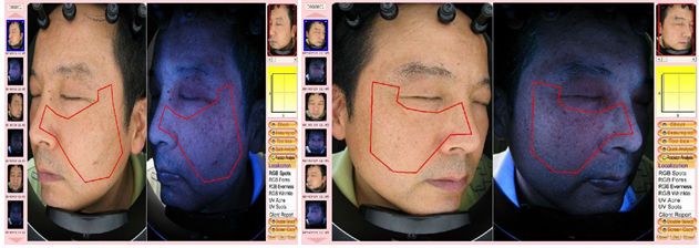 Beauty Salon Used Face Skin Test / Analysis Machine With Hight 12.0 Mega Pixels