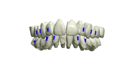 Dental Design Service