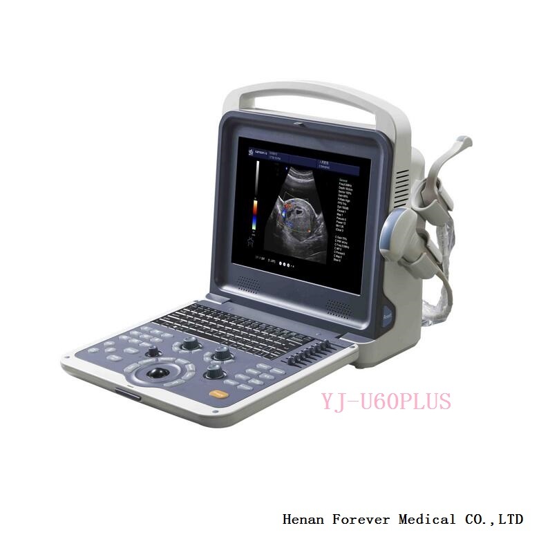 Most Advance Technology Digital Diagnostic Instrument Ultrasound System