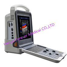 Most Advance Technology Digital Diagnostic Instrument Ultrasound System