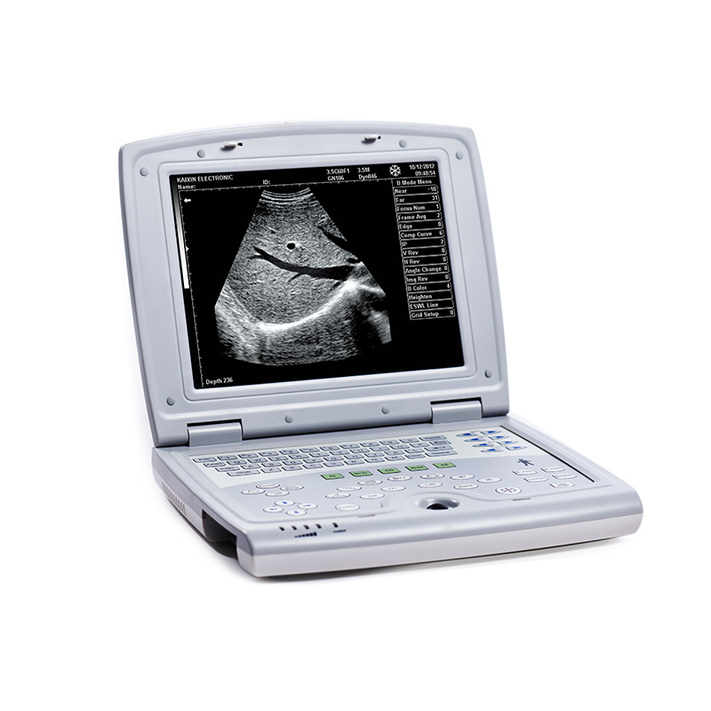 Ultrasound Scanner Hospital Equipment Laptop Design