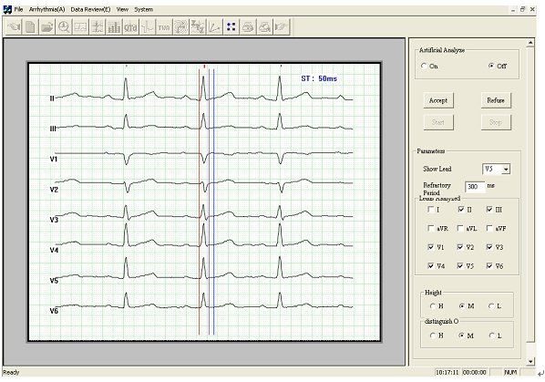 FDA 24 Hours Dynamic ECG Holter 12 Channel EKG Recorder  Analyzer+Software,USA 